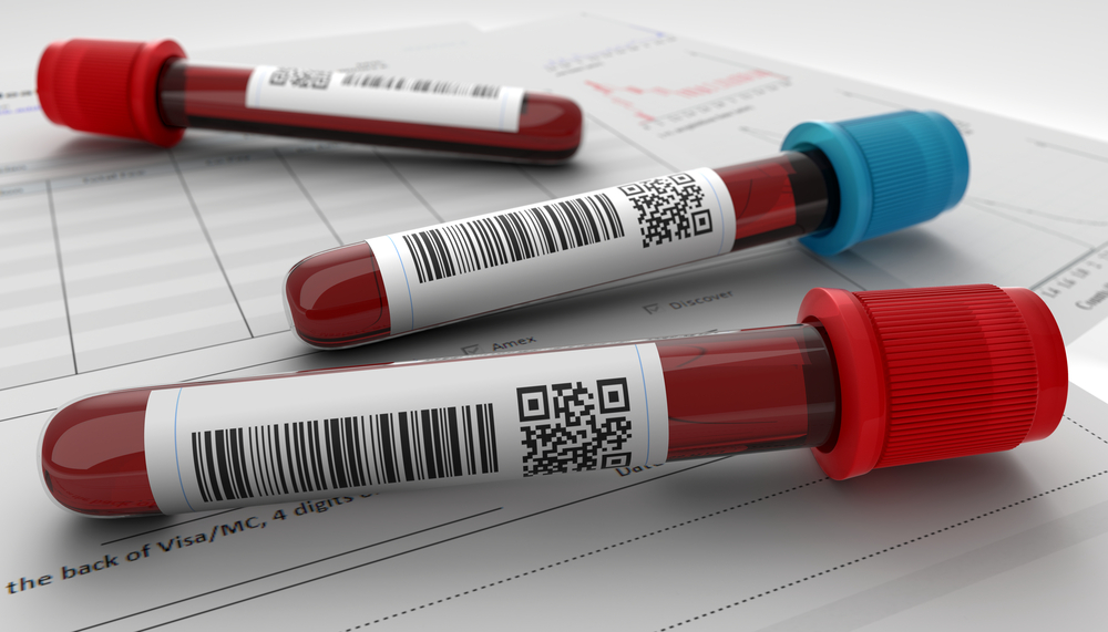 Erythrocyte sedimentation rate explained HealthStaffEd